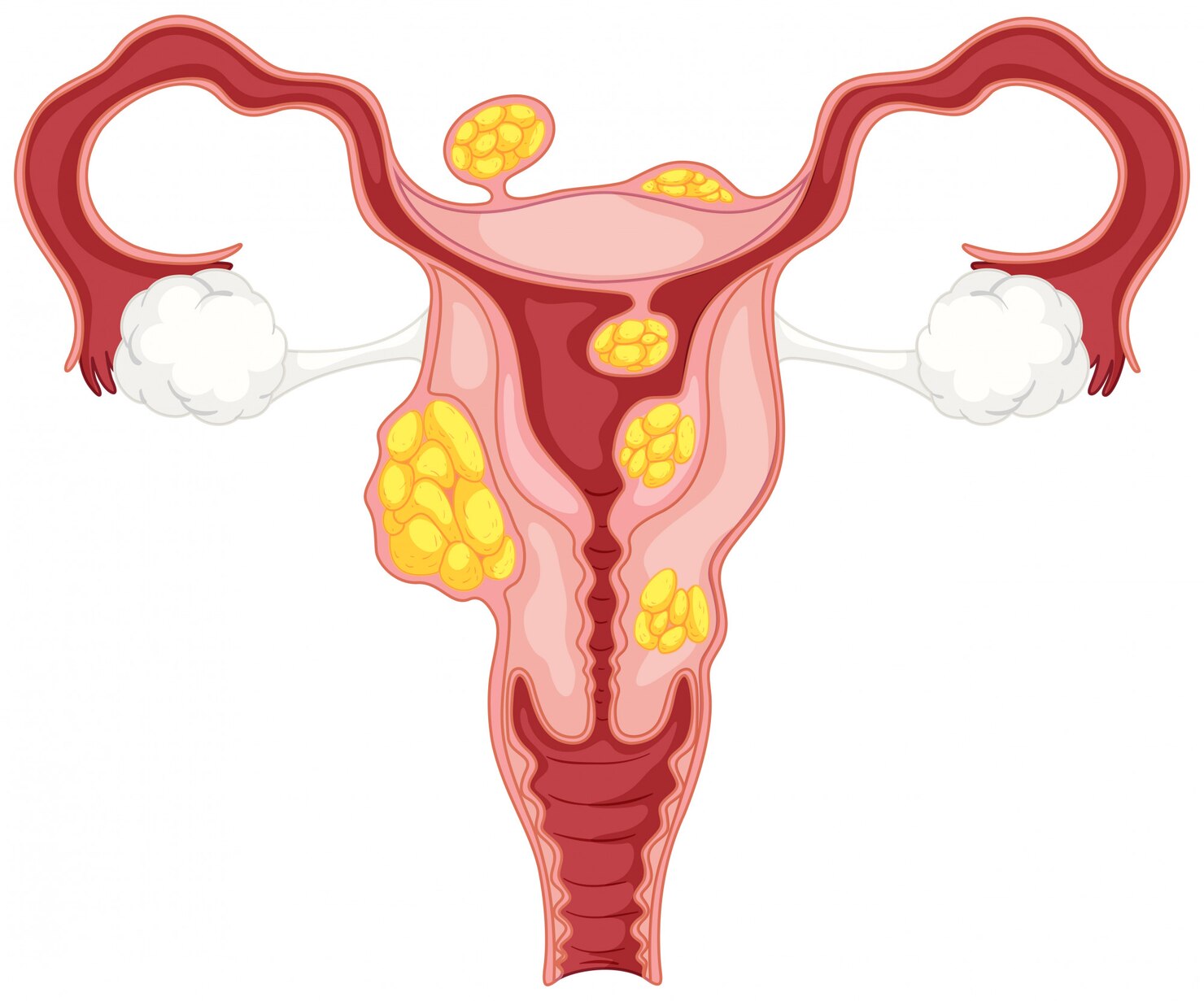 Medical illustration of the female reproductive system including the cervix